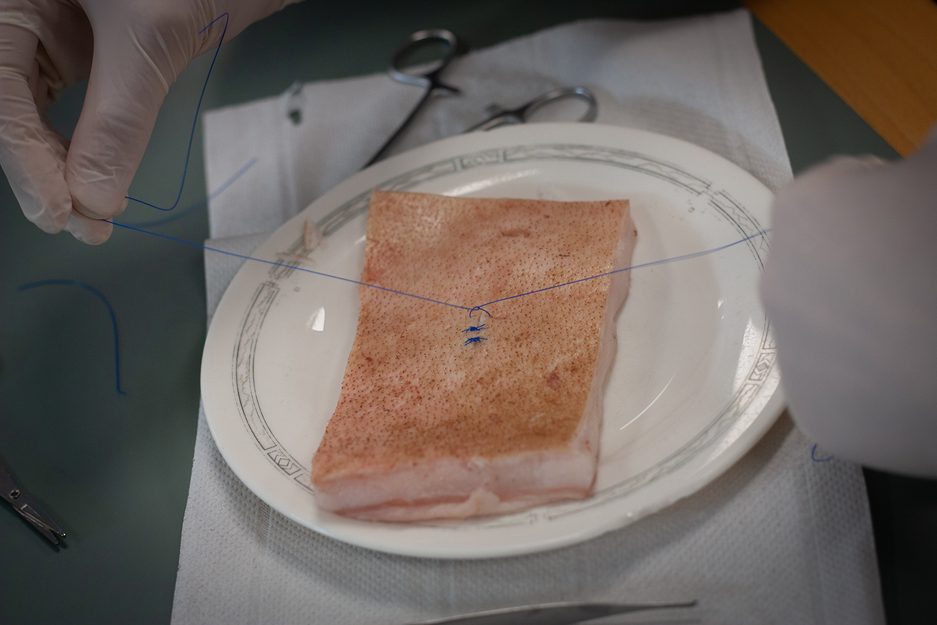 suture